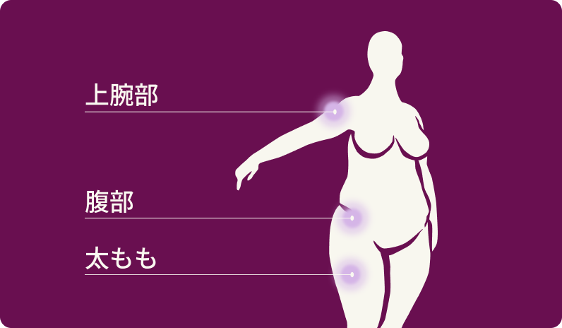 Injection sites (1).png